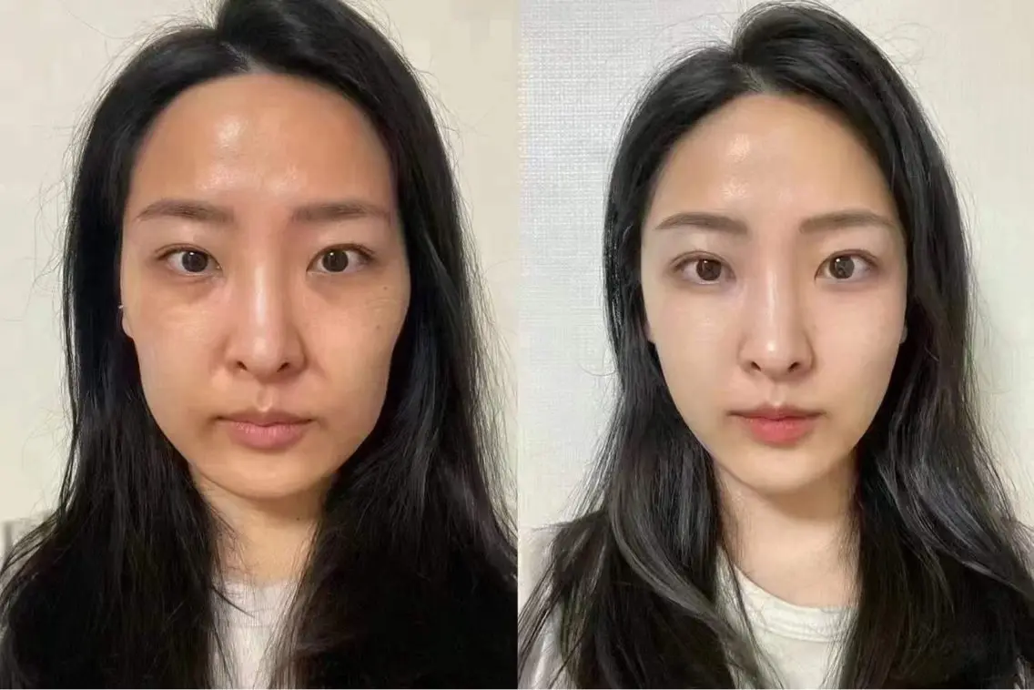 マツエク・マツパ 韓国風マツエク aliaハーブ水光店 エステティシャン募集のエステ・リラクイメージ