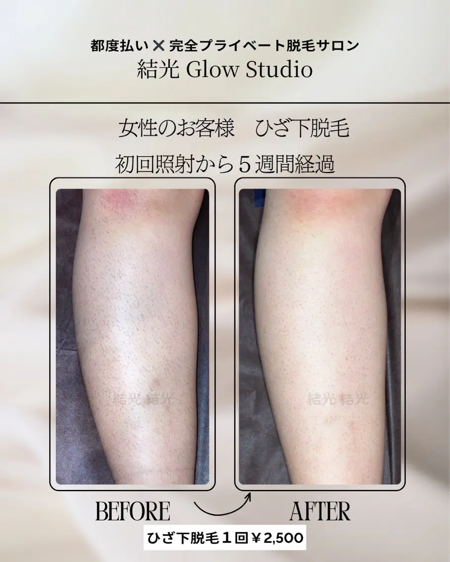 脱毛 結光Glow Studioのエステ・リラクイメージ