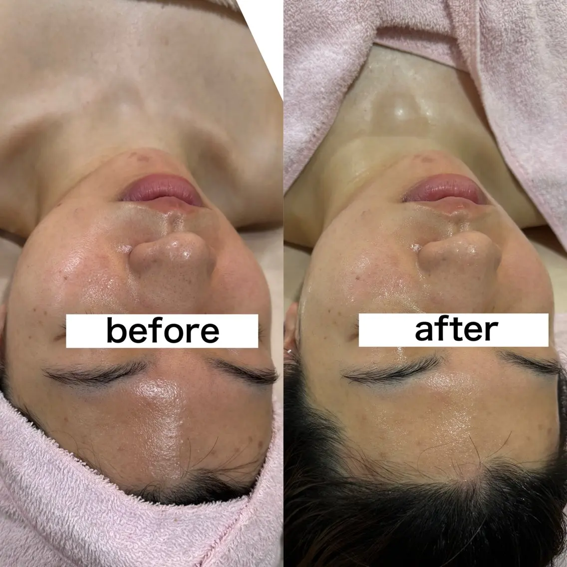 salondeBe 🩵フェイシャル専門のエステ・リラクイメージ