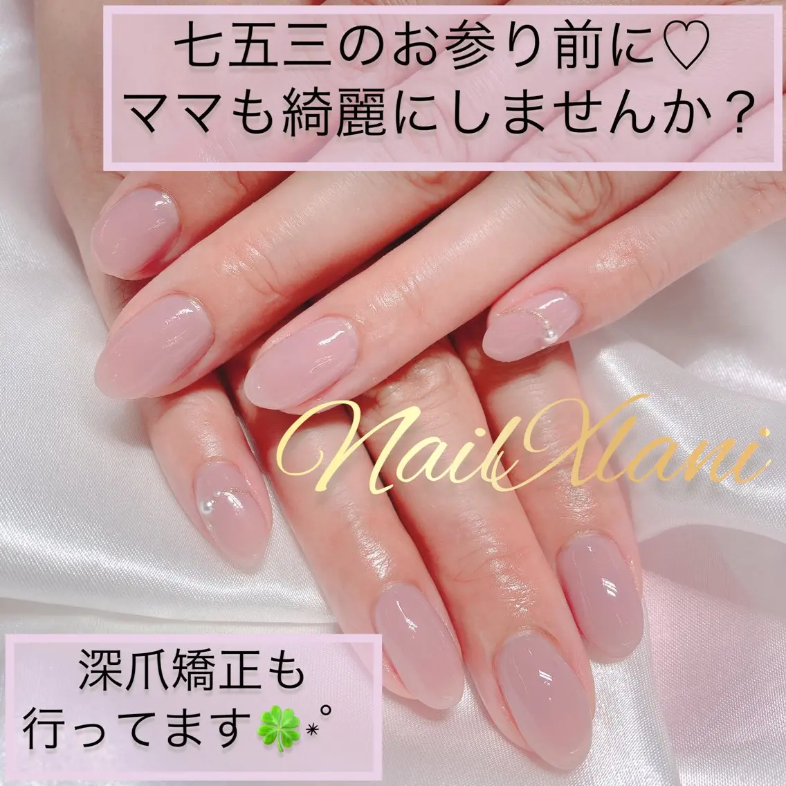 ネイル ハンドネイル Nail×Lani 深爪矯正対応◎のネイルデザイン