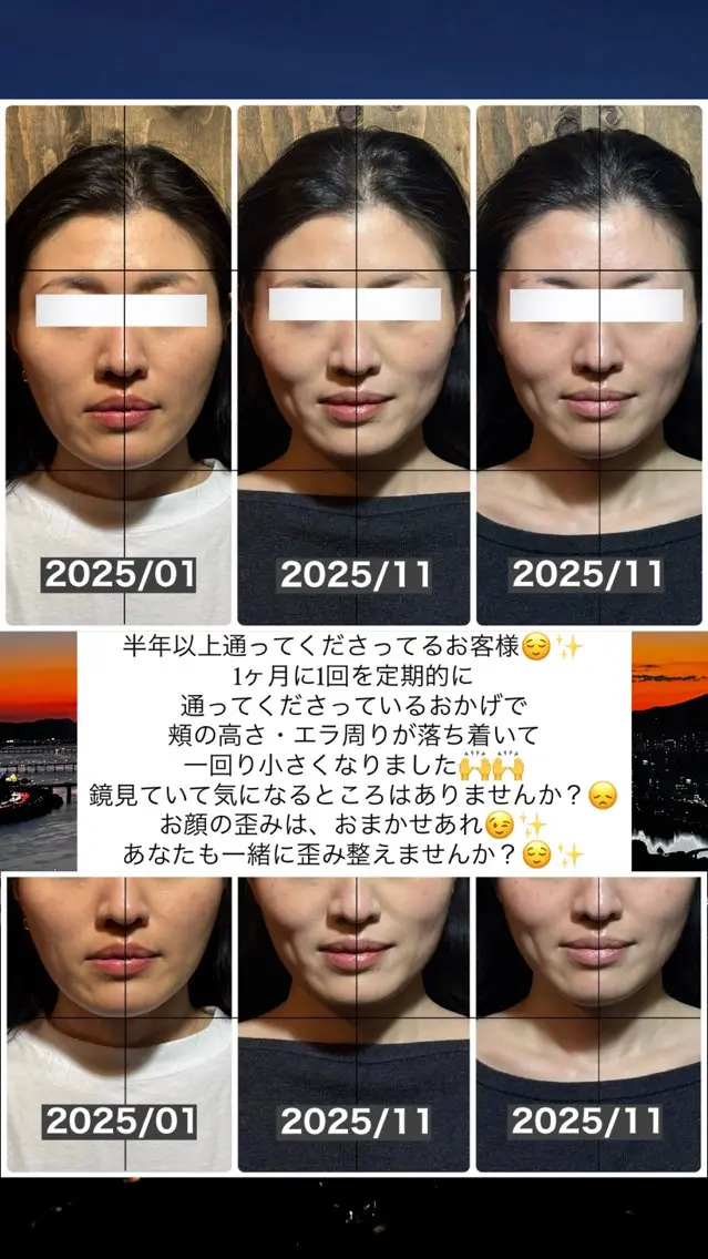 エステ リラク 💎後悔させない小顔 矯正💎イトヤマ🌱のエステ・リラクイメージ