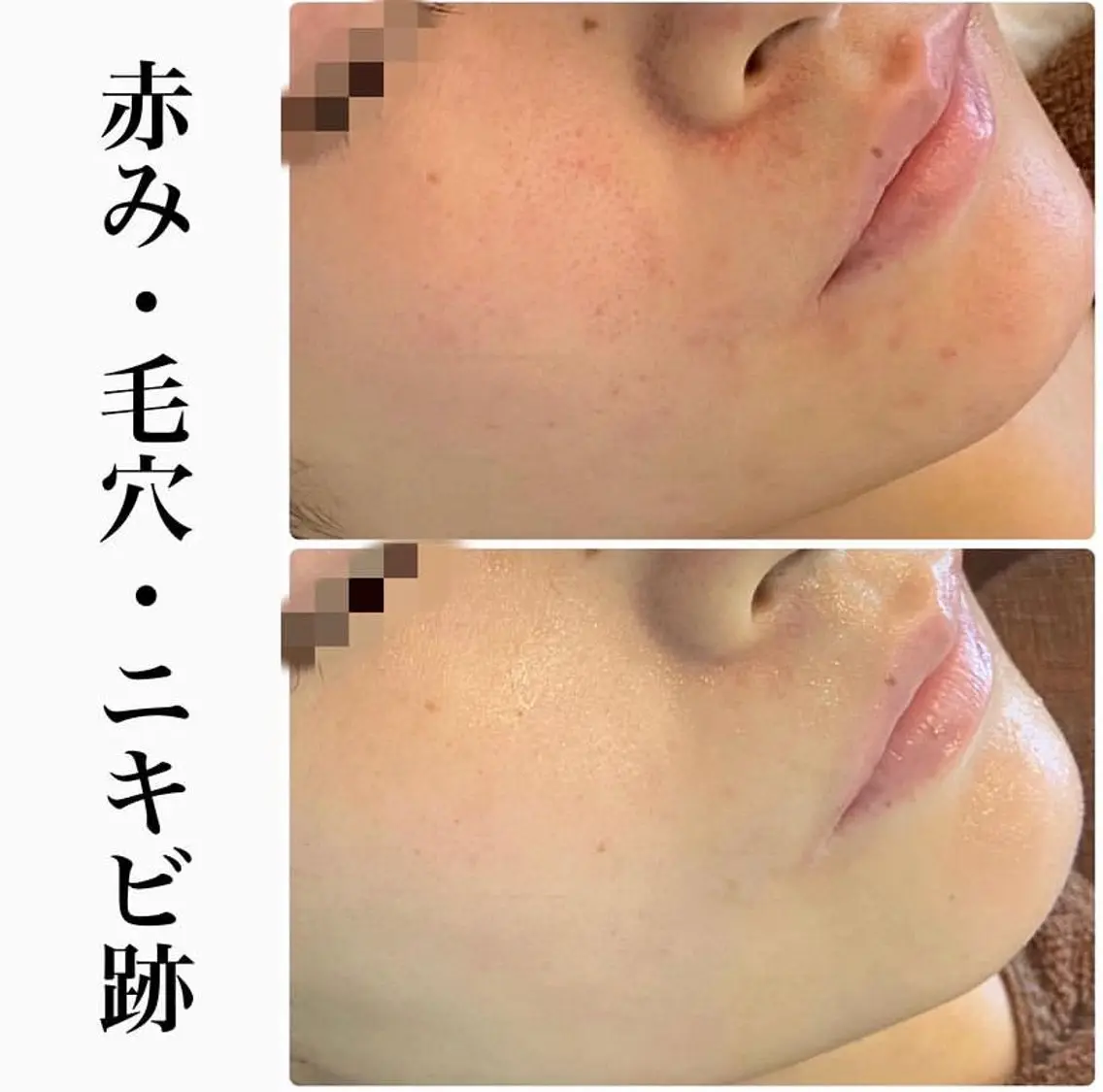 エステ ハーブピーリング専門 BIOEL横浜のエステ・リラクイメージ