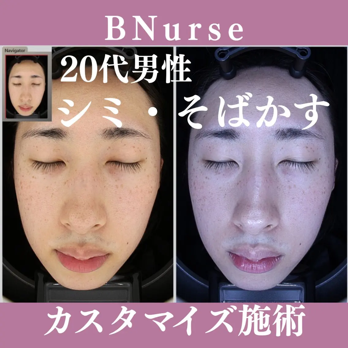 メンズ 美容看護師専属担当制 医学に基づく肌管理のエステ・リラクイメージ