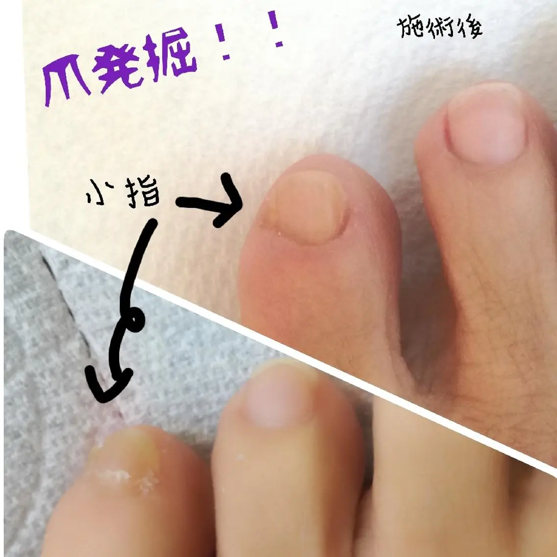 ネイル コエリネイル &エステのネイルデザイン