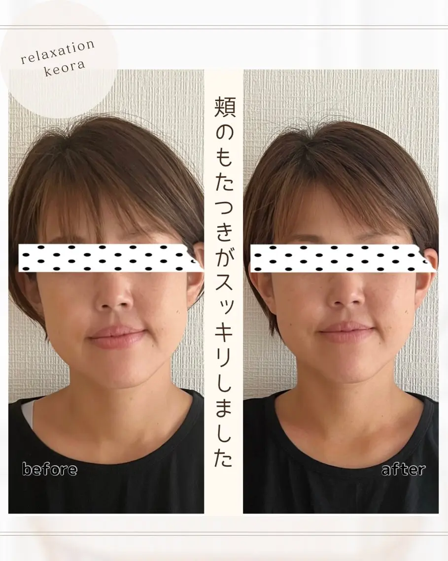 【小顔矯正】90分　エラ 頬骨 むくみ⁂特殊な技術でスッキリ改善！症状が軽い方＊まずはお試し◎の写真