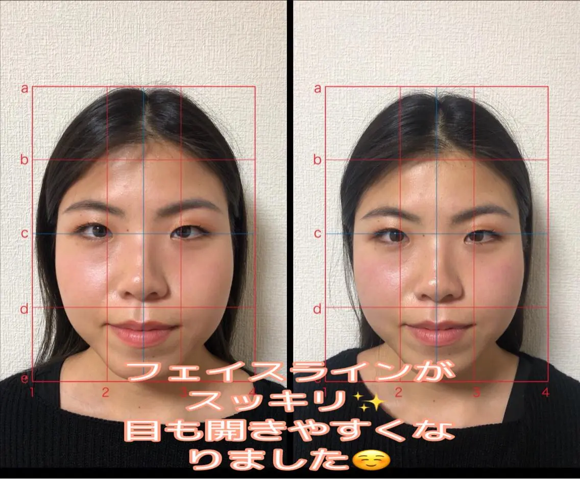 やはた 鍼灸整骨院のエステ・リラクイメージ