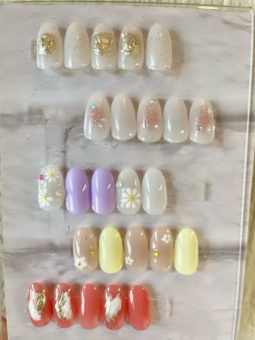 定額制★ケアオフ込み料金です。※フィルイン施術の写真