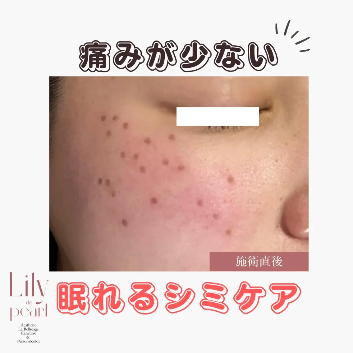 最新シミケアLily de pearlのエステ・リラクイメージ