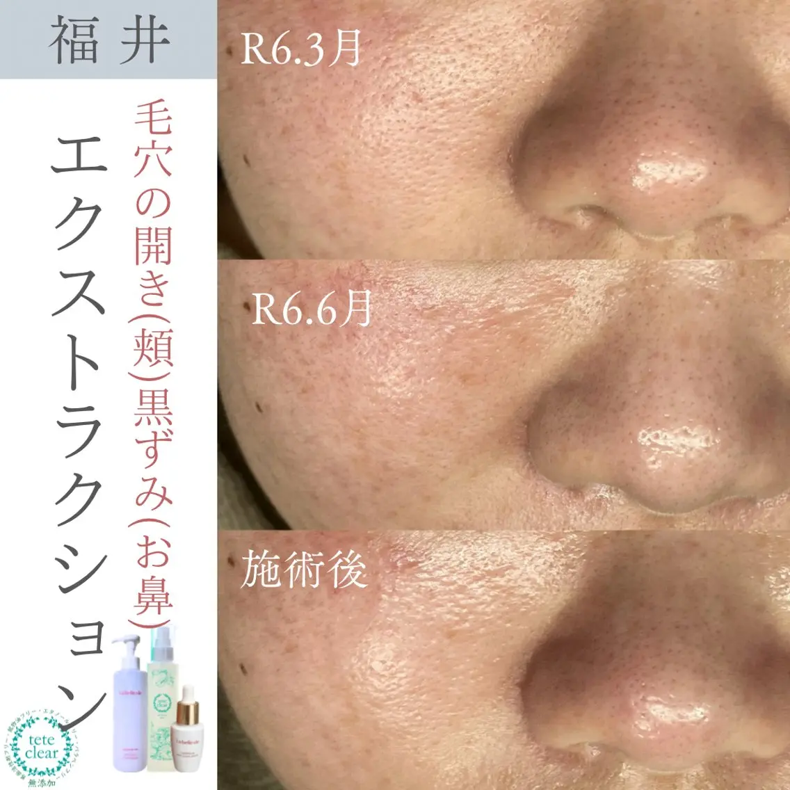 毛穴肌質ケアサロン Yourmeユアミーのエステ・リラクイメージ