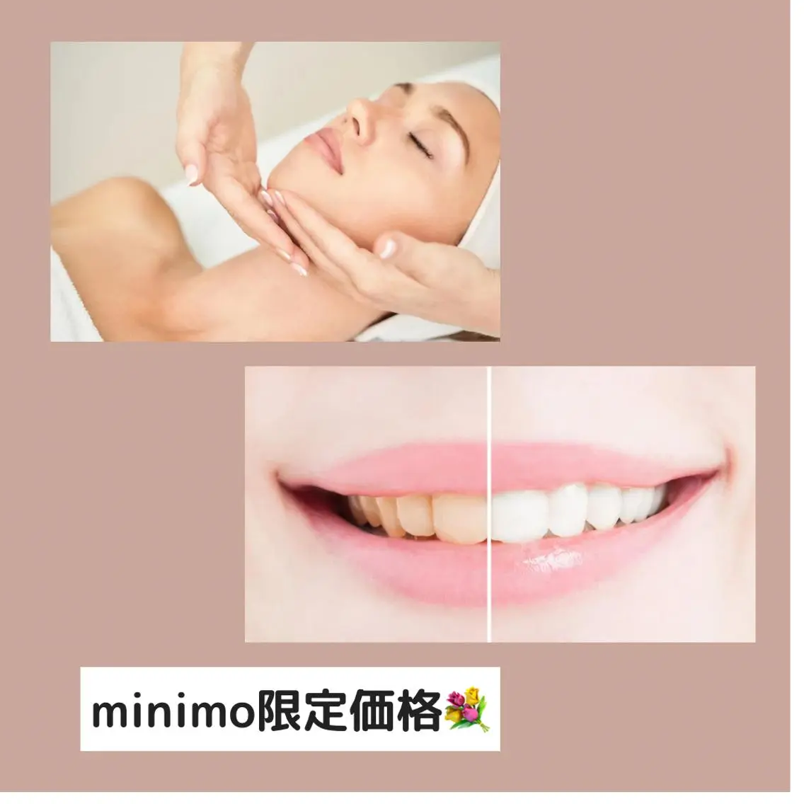 計4照射🦷ハイパワーセルフホワイトニング+9分照射×2回 2セットの写真