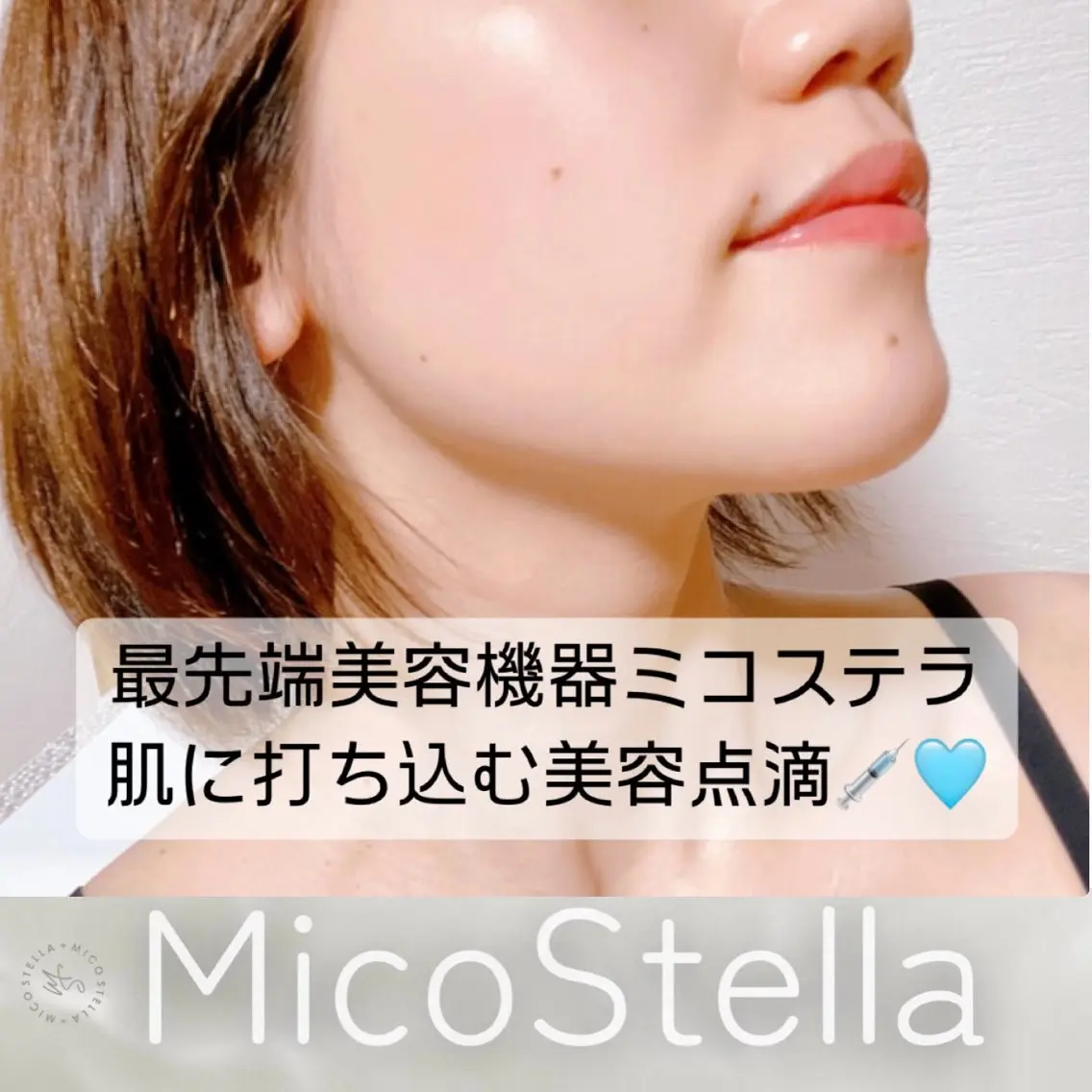 【ツヤ・乾燥肌に】高濃度酸素注入+セラミド注入でしっとりお肌に🫧の写真