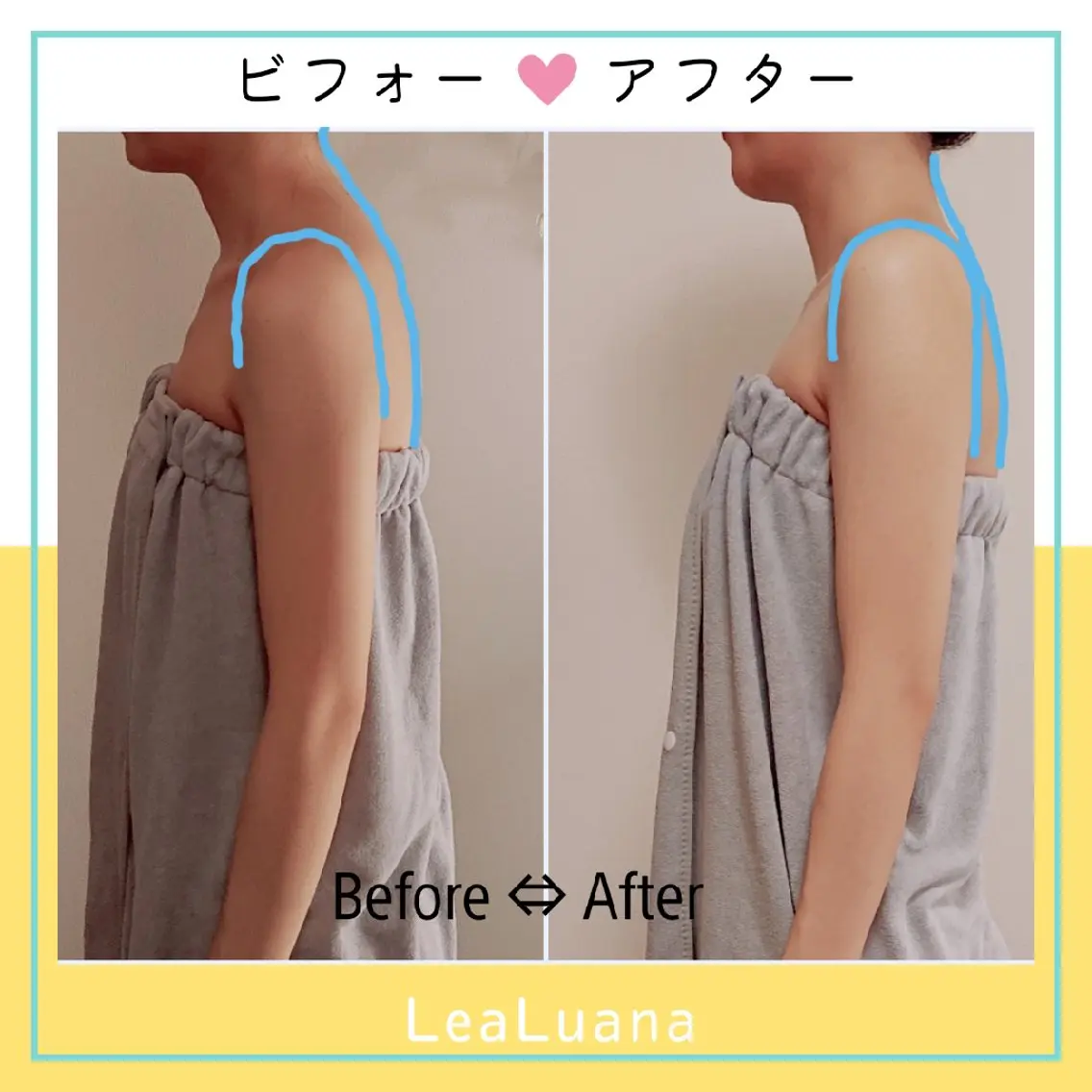 【👑人気No.1】痩せ見え!!美姿勢ﾒｲｷﾝｸﾞ60分/理想の上半身へ✨猫背/反り腰/巻き肩/肩ｺﾘの写真