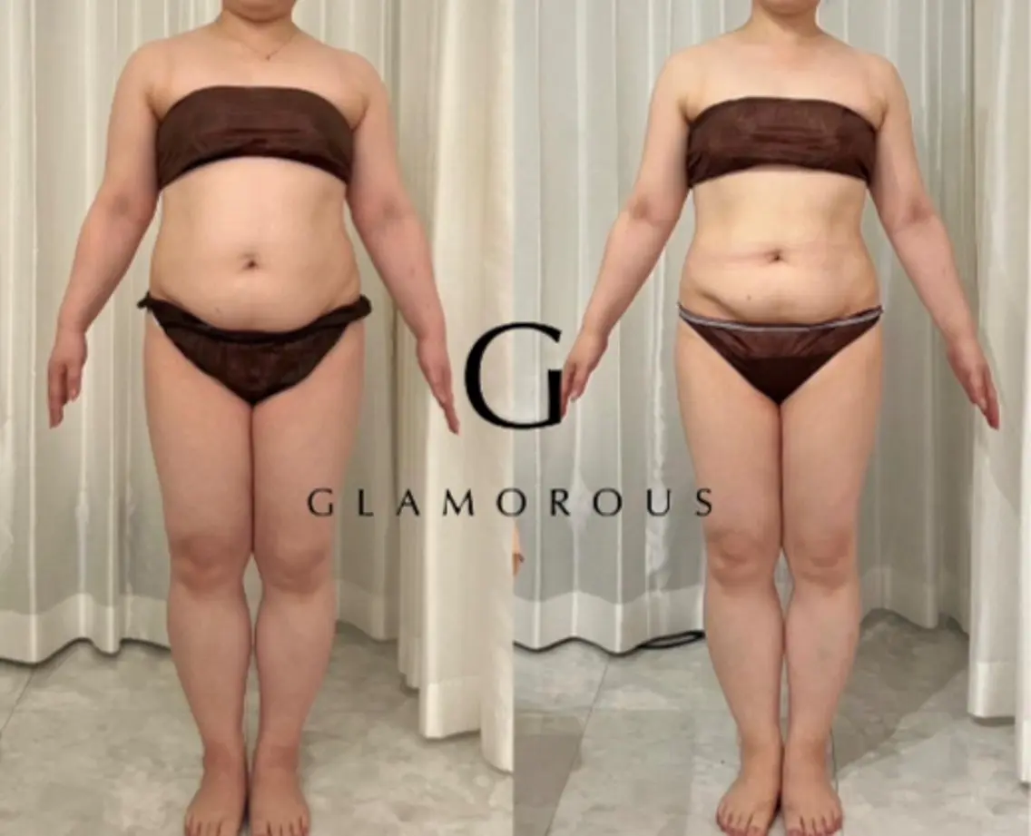 熊本｜何しても痩せない女性専用本気の体質改善ダイエット体験の写真