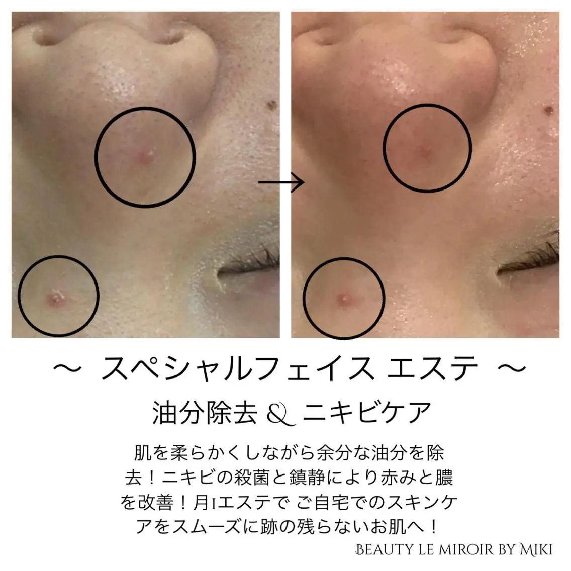 ビューティー ミロワールのエステ・リラクイメージ