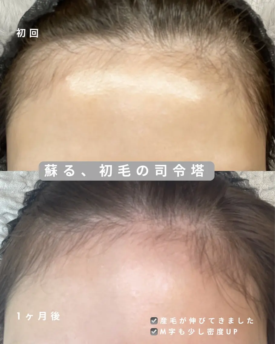 cocofleur 美容看護師監修サロンのエステ・リラクイメージ