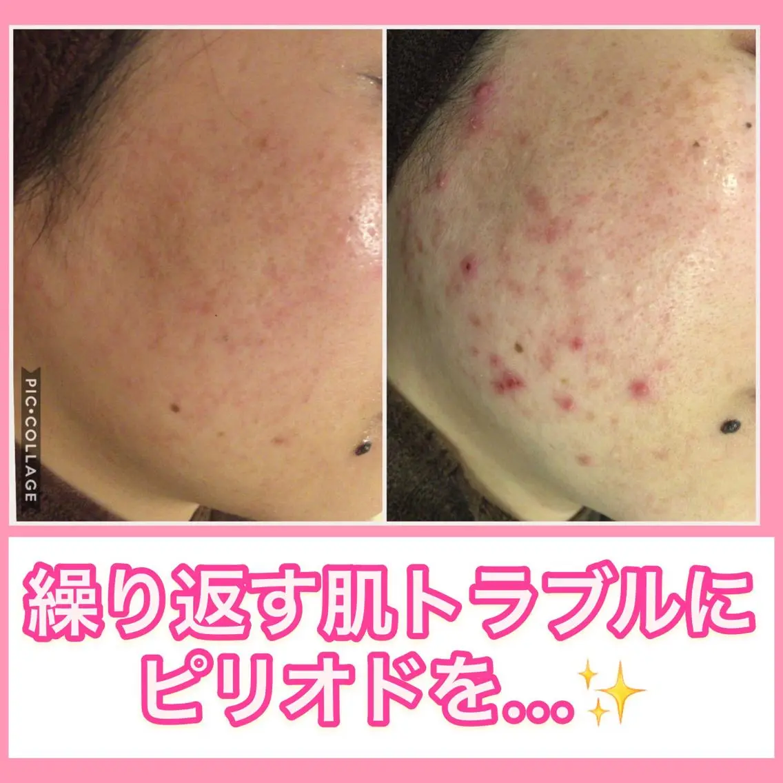 ミディアム カラー パーマ ヘアアレンジ メンズ キッズ ネイル マツエク・マツパ ニキビ・肌質改善専門 ♡人生が変わるサロンのエステ・リラクイメージ