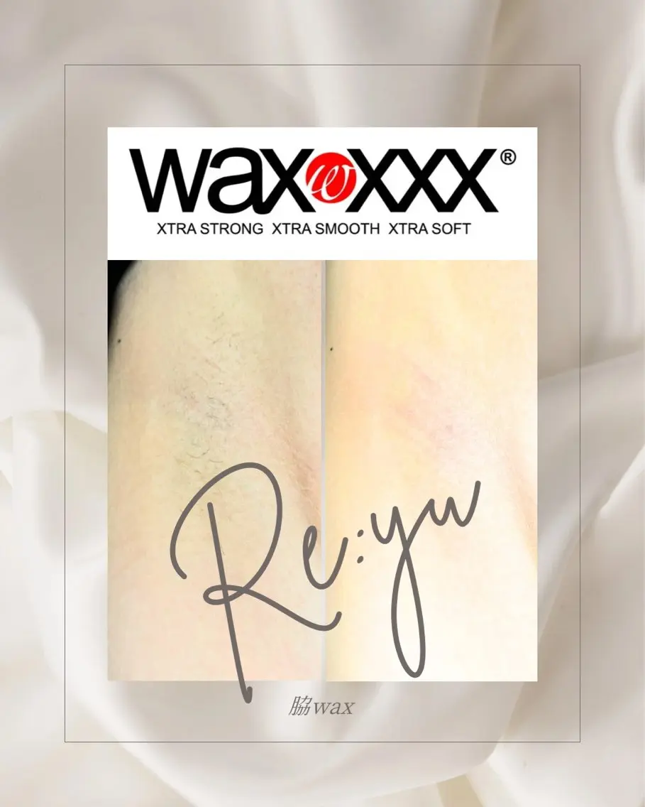 両脇wax脱毛の写真