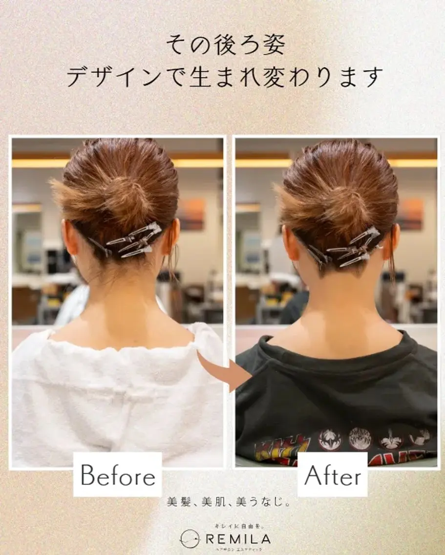 ショート 脱毛 宇田川 直輝のヘアスタイル