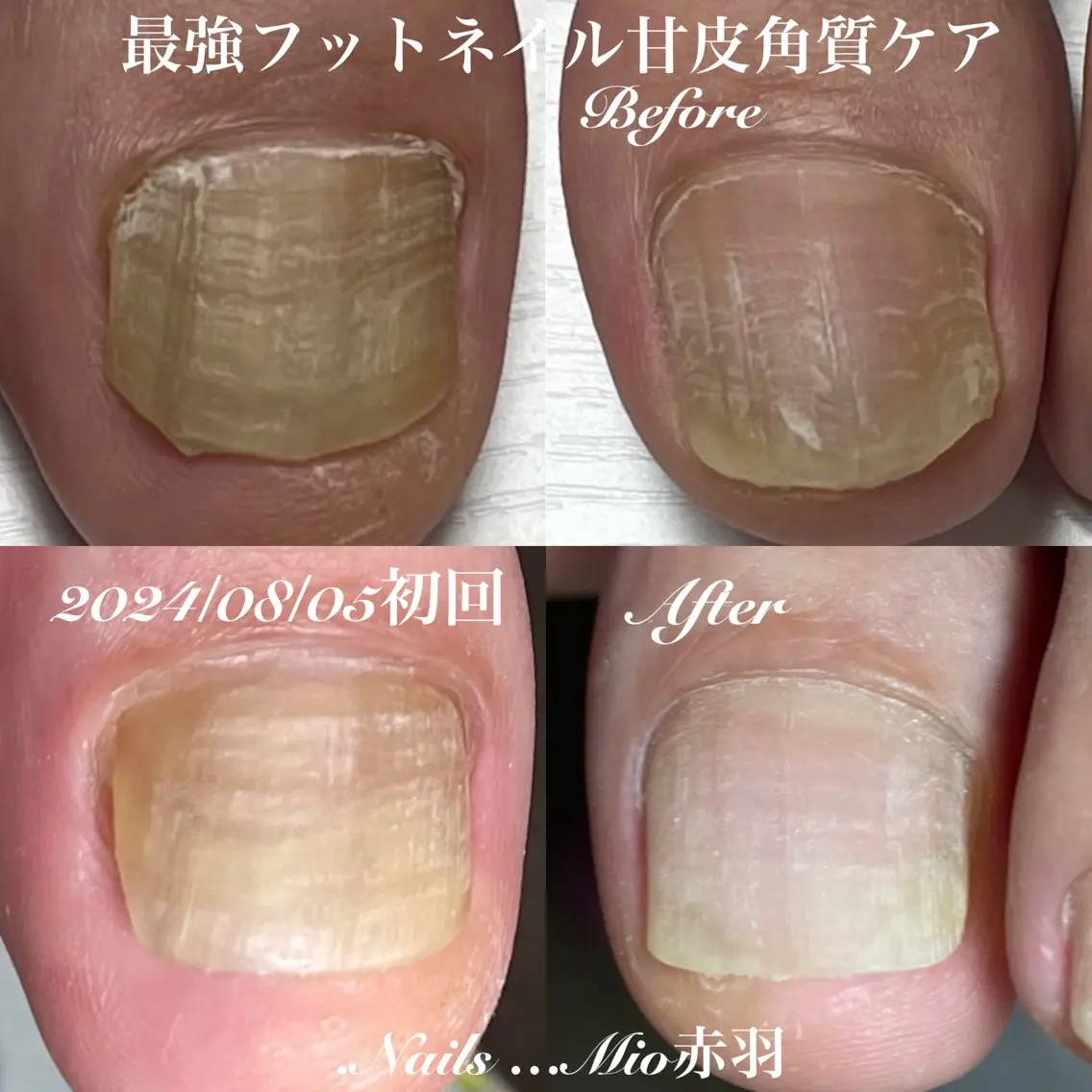 ネイル フットネイル .Nails Mio 赤羽西ネイルサロンのネイルデザイン