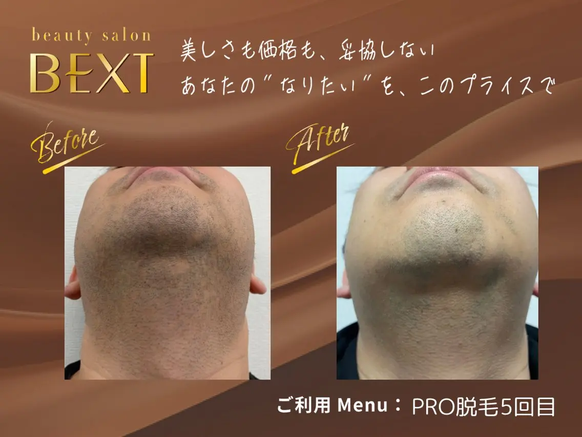 メンズ 脱毛 ビューティーサロン ベクスト名古屋のエステ・リラクイメージ