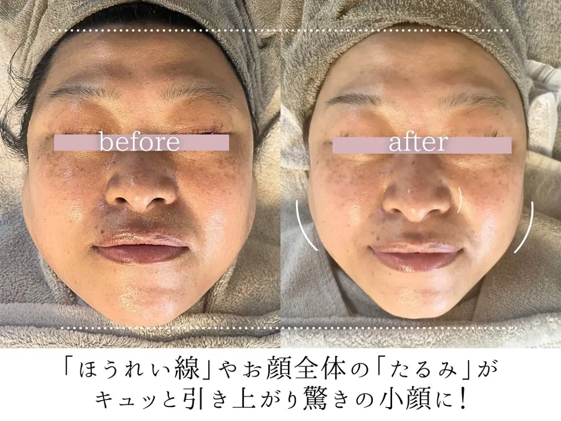 その他 頭蓋骨小顔コルギ Permのその他イメージ