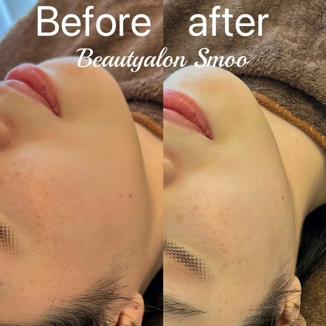 エステ Smoo アユミの眉毛・アイブロウイメージ
