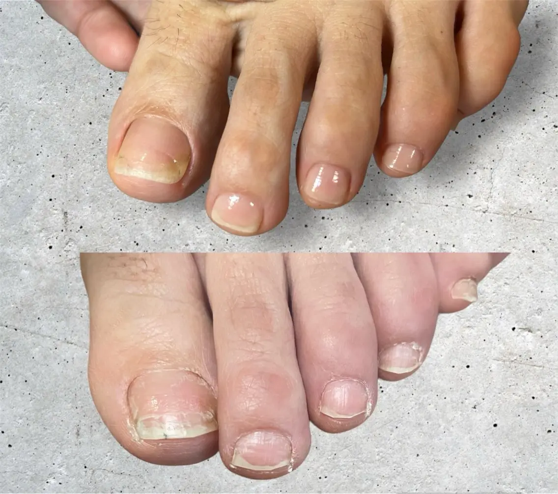 ネイル フットネイル cscnail keikoのネイルデザイン