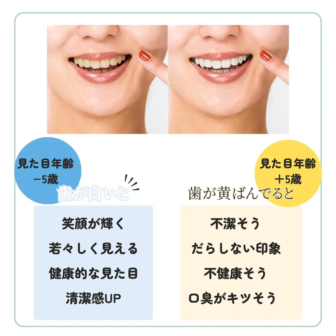 東区香椎歯のセルフホ ワイトニングGLOWのその他イメージ