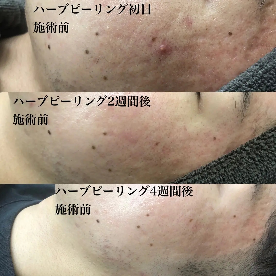 メンズ エステサロン NINEのエステ・リラクイメージ