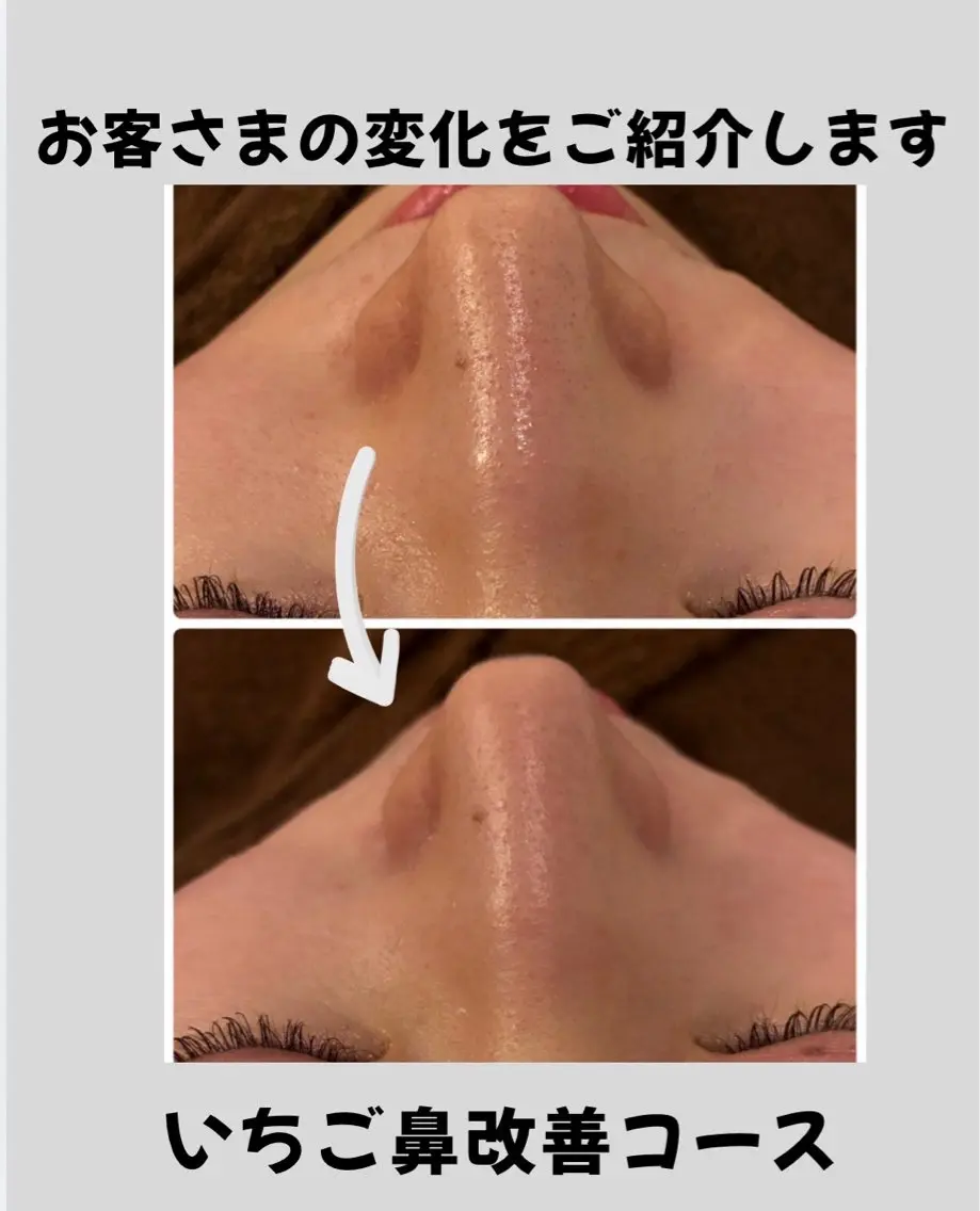 エステ 中平 あきなのエステ・リラクイメージ