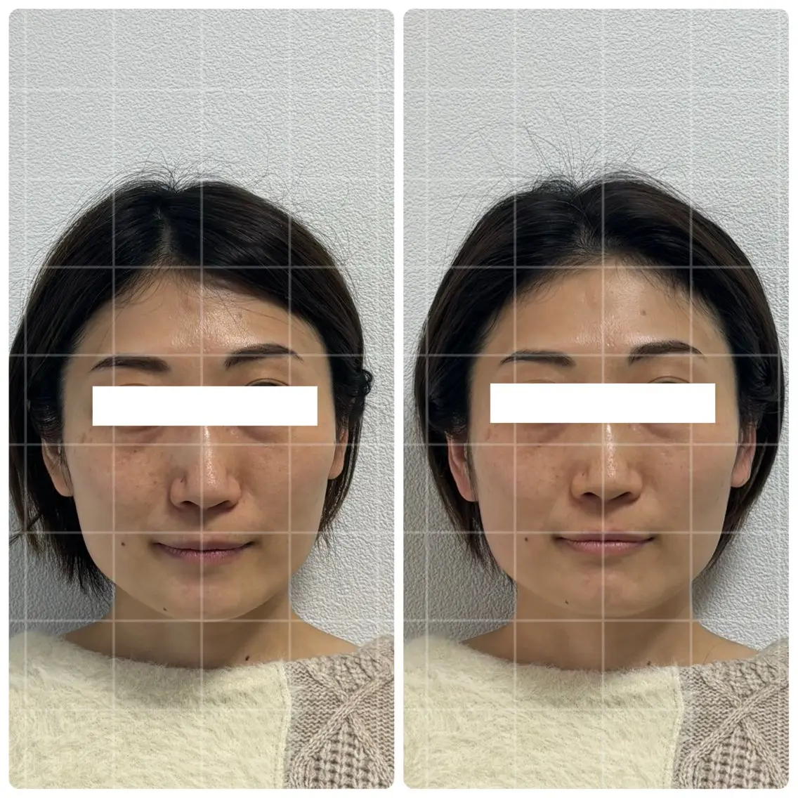 片山けいこ｜ 美人顔創りの専門家のエステ・リラクイメージ