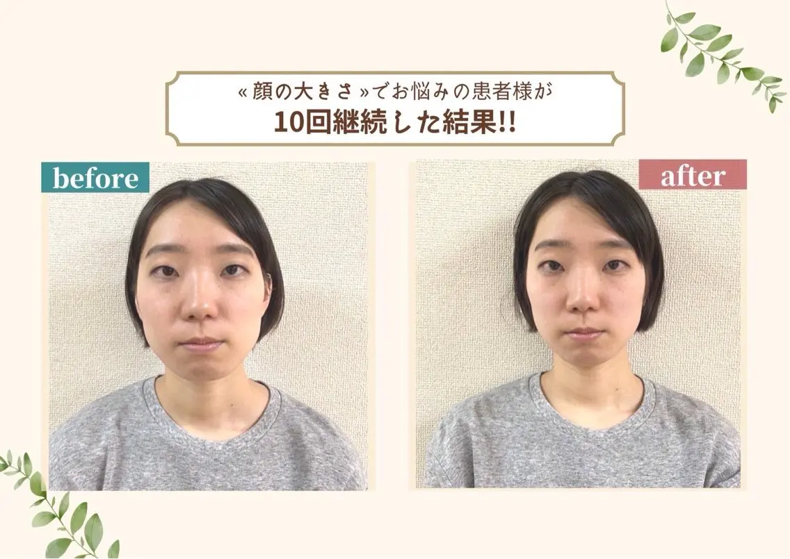 【変化No.1！歪み改善】目の高さ&左右差＋小顔矯正＋骨盤矯正 15,900円→1,000円‼️の写真
