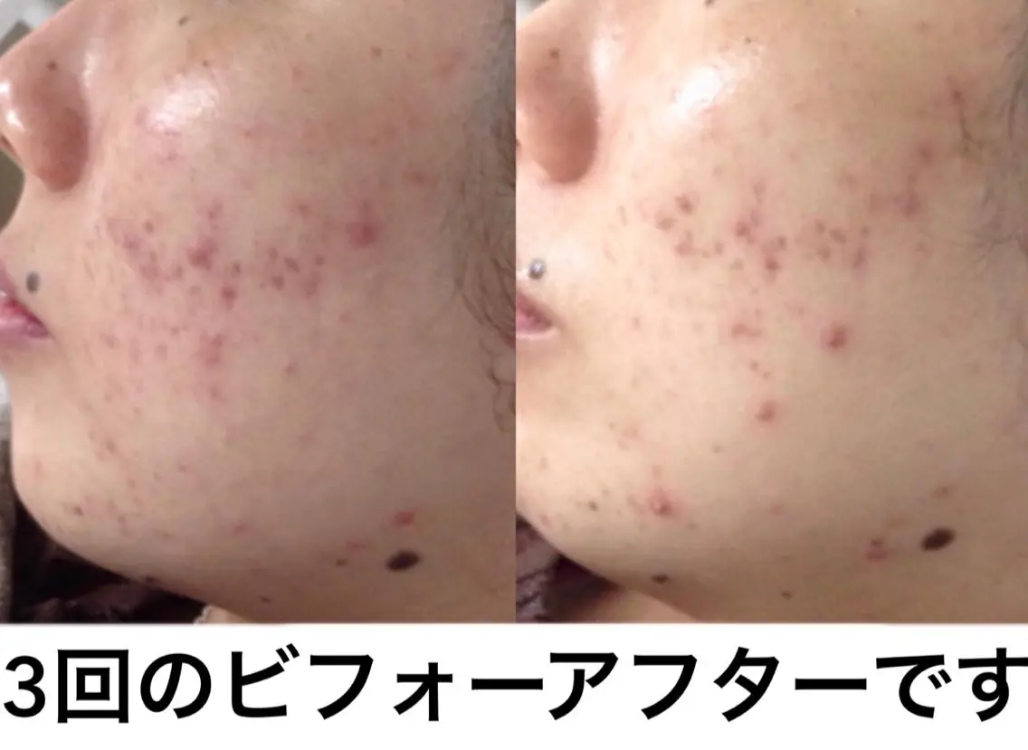 ミディアム カラー パーマ ネイル マツエク・マツパ エステ リラク 都度払い肌質改善 &脱毛Blancheのエステ・リラクイメージ