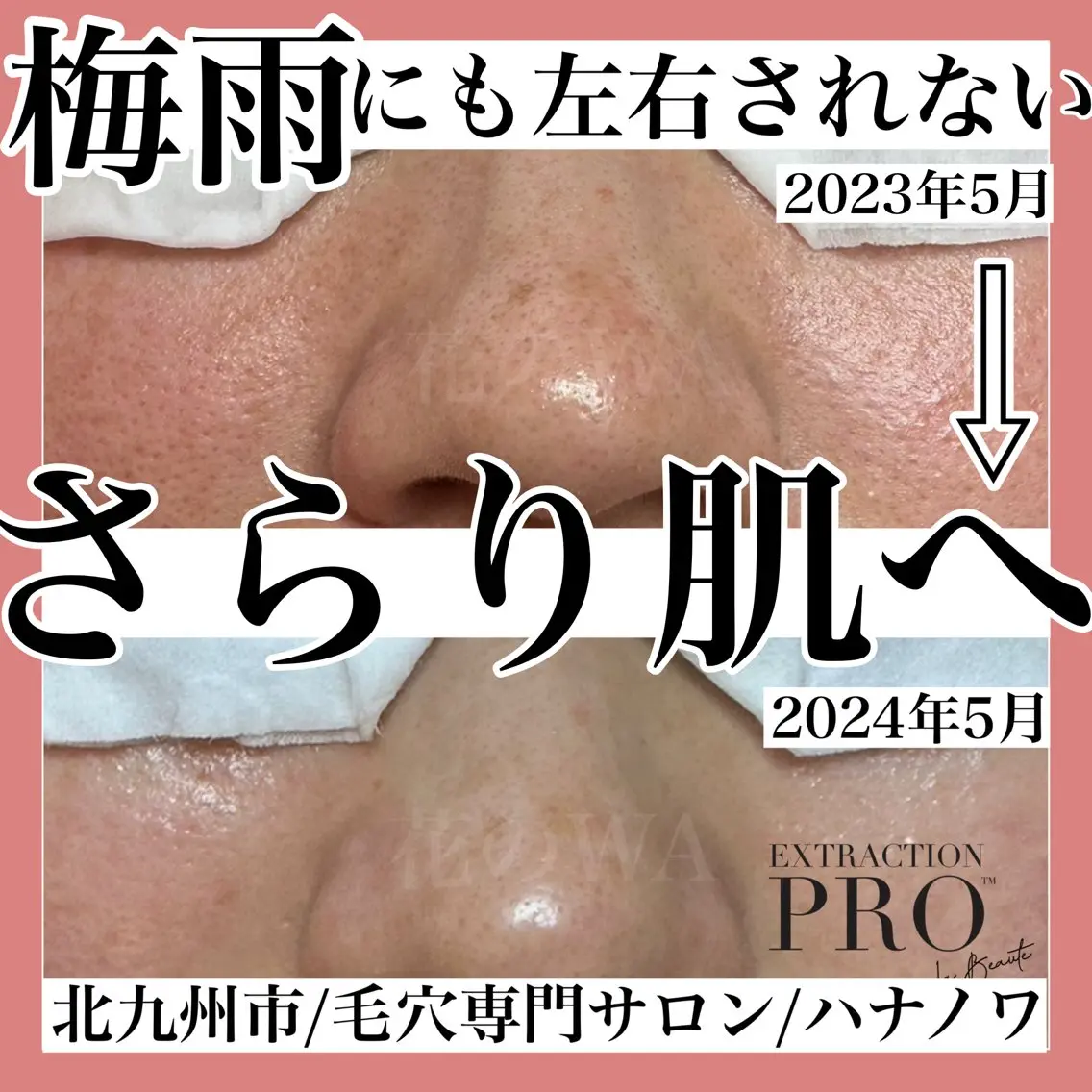 エステ リラク 毛穴&リンパマッサー ジ専門サロン花のWAのエステ・リラクイメージ