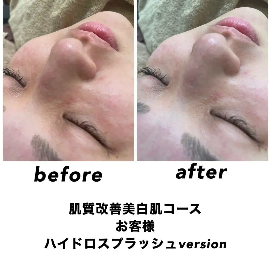 ネイル・エステサロン UILANIのエステ・リラクイメージ