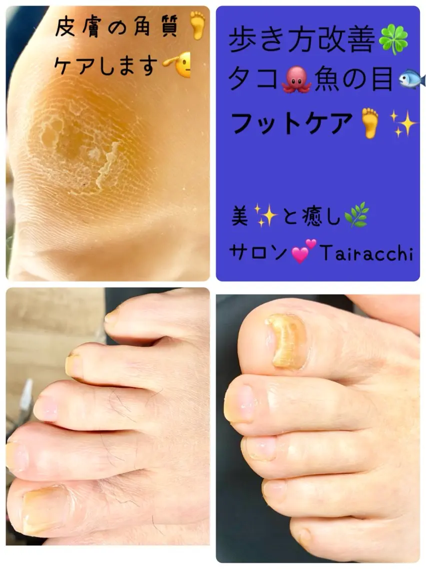 ネイル フットネイル フットネイル Tairacchi タイラッチのエステ・リラクイメージ