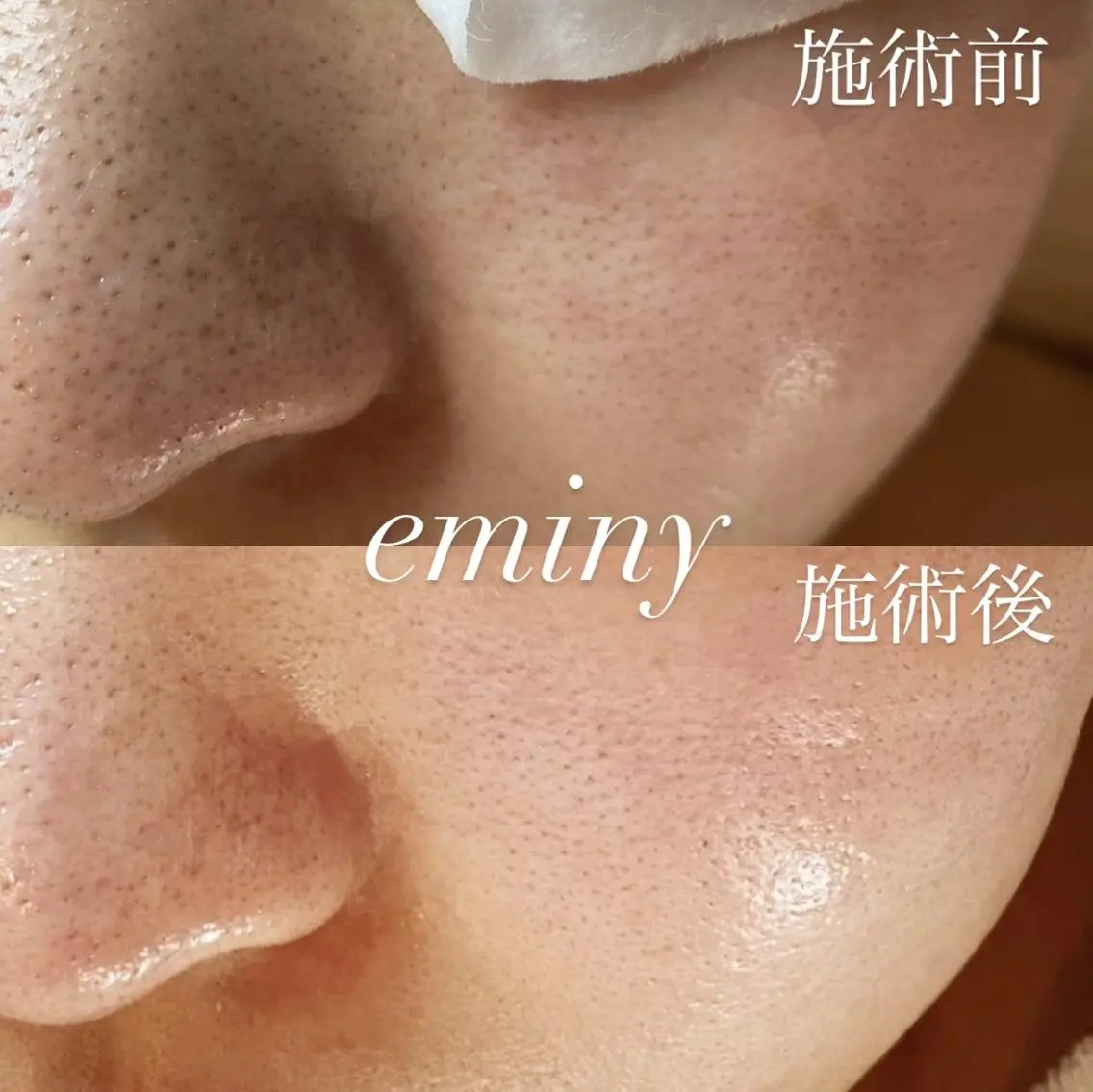 EMINY (エステティシャン)のエステ・リラクイメージ