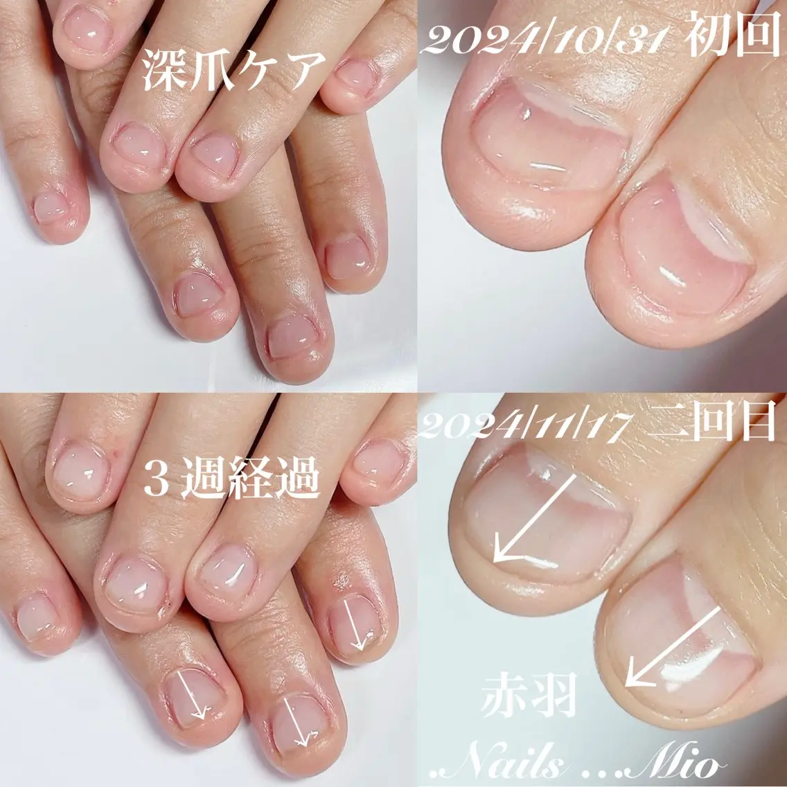ネイル クリアネイル ジェルネイル .Nails Mio 赤羽西ネイルサロンのネイルデザイン