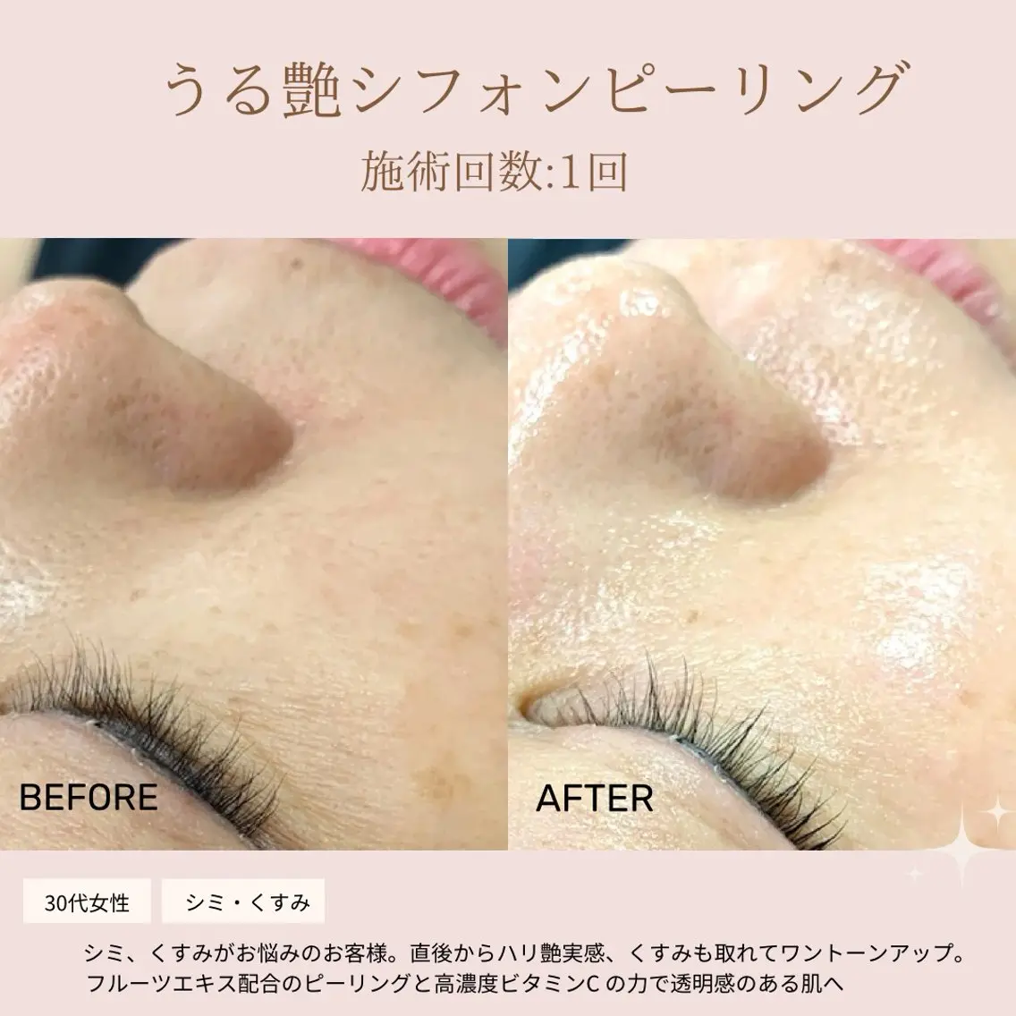 肌質改善専門サロン Bellmi/心斎橋のエステ・リラクイメージ