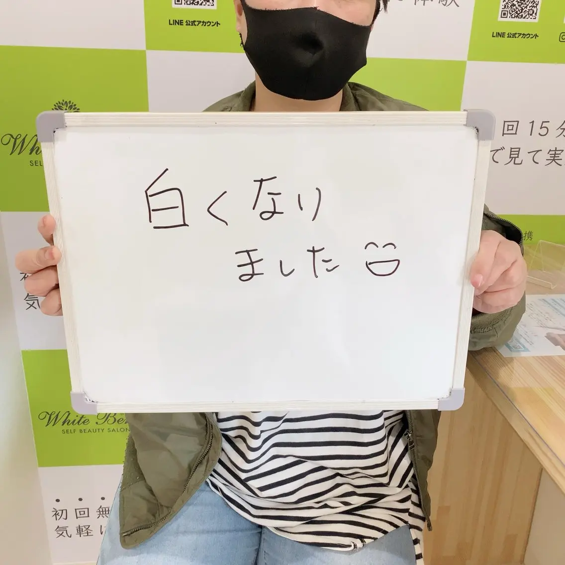 セルフホワイトニング 🦷口元垢抜け✨のその他イメージ