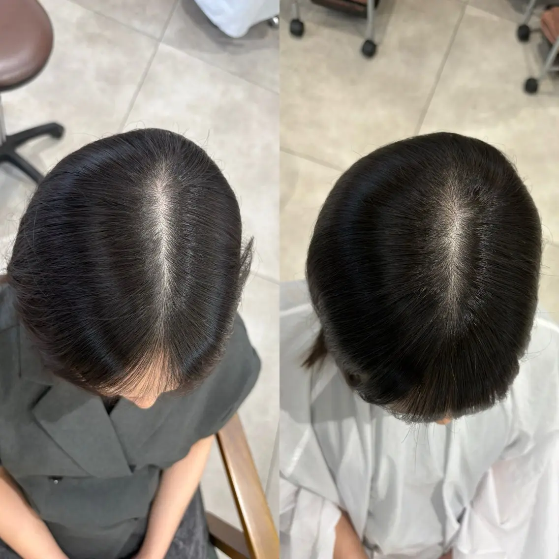⭐️生えぐせ改善 ヘアリセッター✂️のヘアスタイル