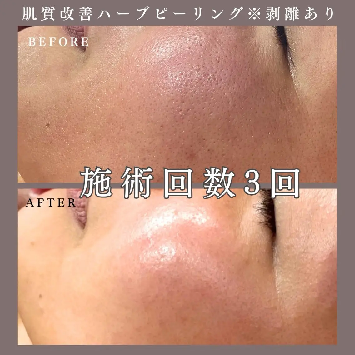 エステ 肌質改善専門サロン Bellmi/心斎橋のエステ・リラクイメージ
