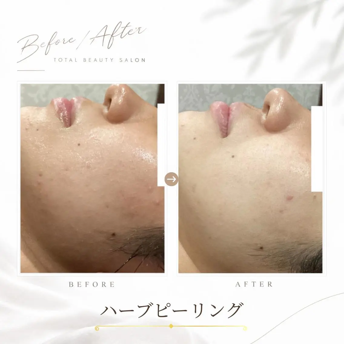 《 肌質×美肌 》 addissimoのエステ・リラクイメージ