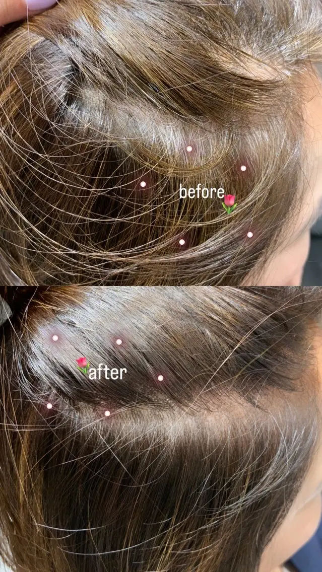 カラー :)) Konoha⋆｡˚✩のヘアスタイル