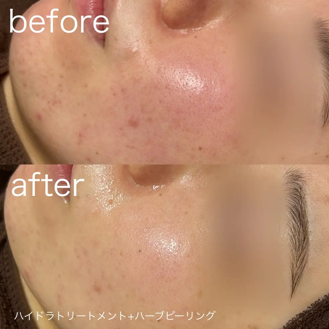 脱毛 lulularico Yuのネイルデザイン
