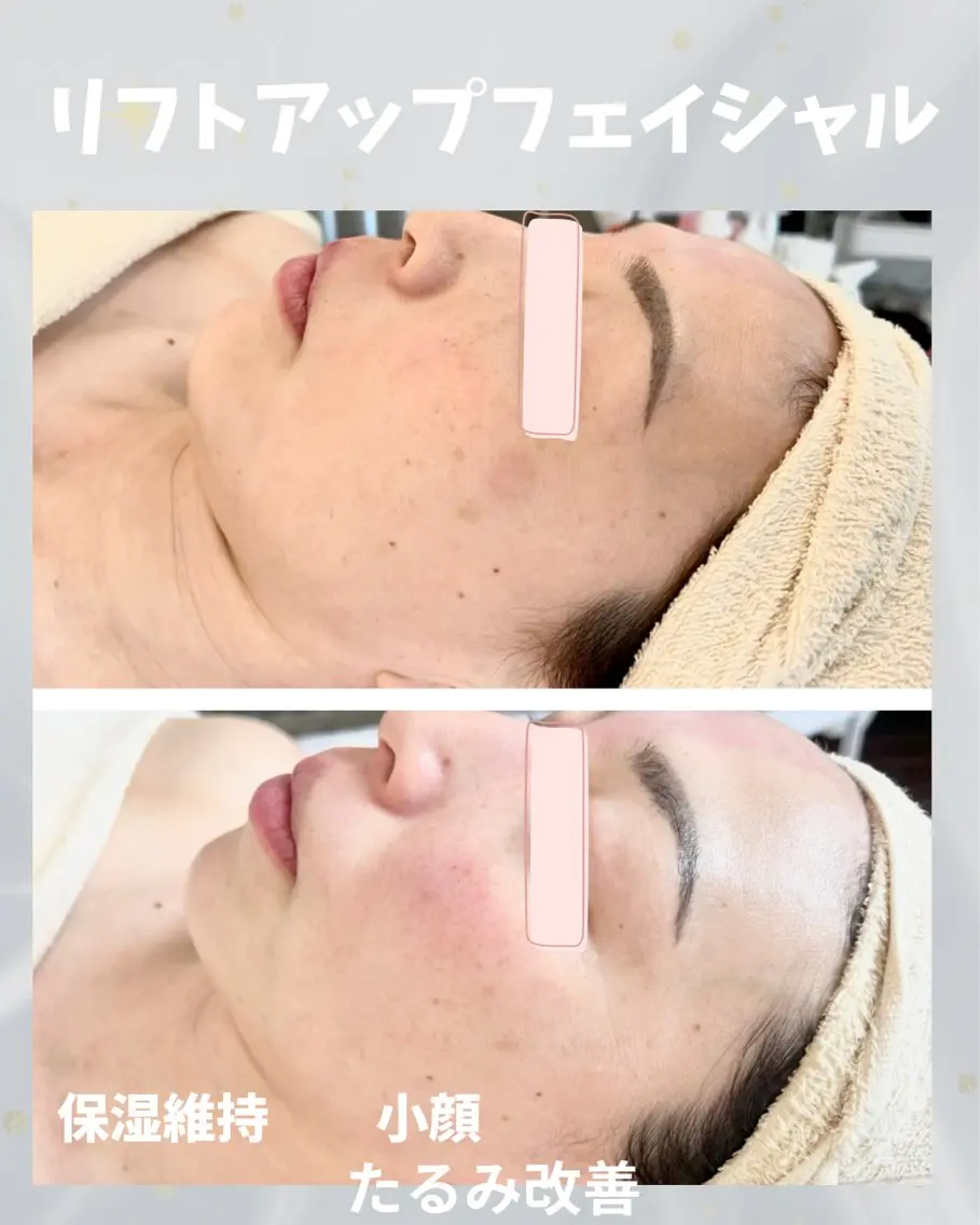 エステ beauty SalonRcoinのマツエク・マツパデザイン