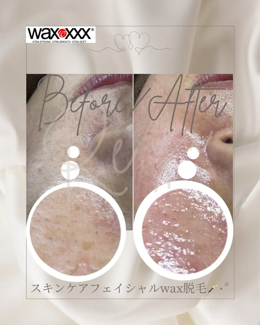Re:yu┃wax 脱毛┃糸島市のエステ・リラクイメージ