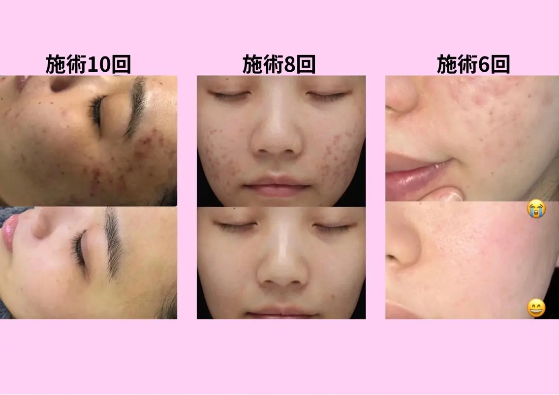 マツエク・マツパ エステ リラク 愛維美水光美肌専門店 メンズレディースokのエステ・リラクイメージ