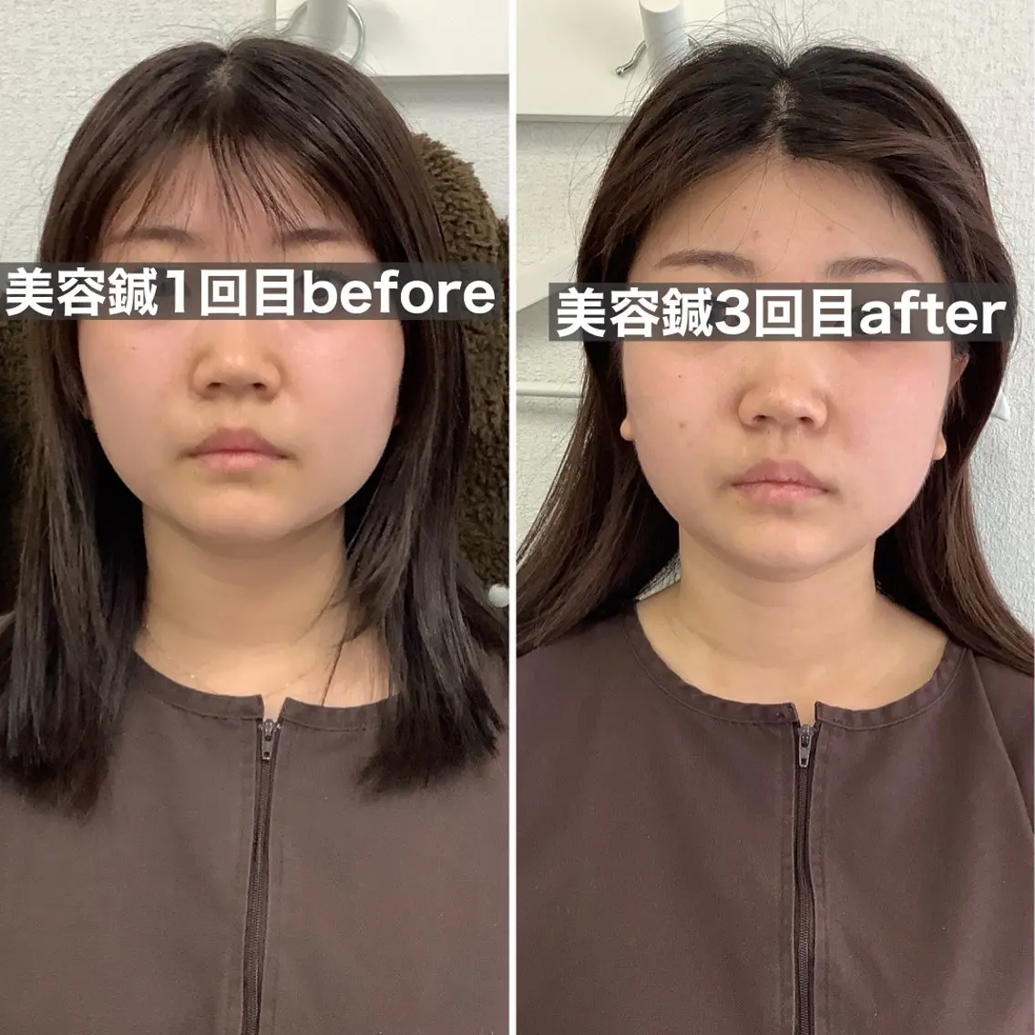 エステ リラク ハリサロンドオフ 美容鍼灸×小顔整体のエステ・リラクイメージ