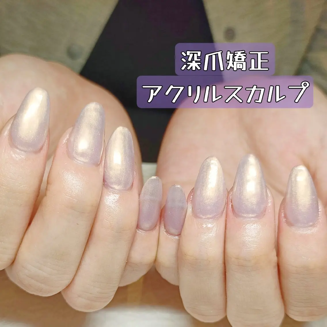 ネイル 長さ出し ハンドネイル ハンドケア 深爪矯正/爪育成ケア manie nailのネイルデザイン
